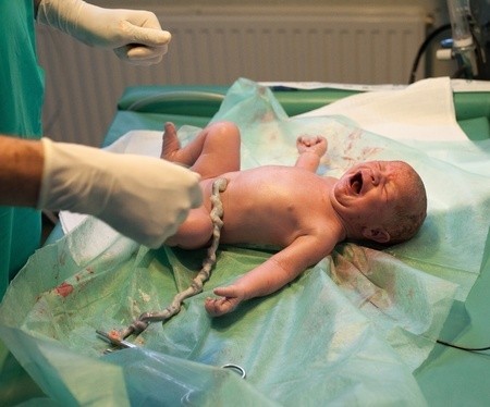 schreiendes Neugeborenes auf einem medizinischen Tisch