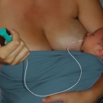 Mutter füttert ihr Baby an der Brust mit der Sonde
