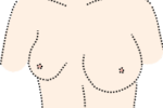 asymmetrische Brüste (Zeichnung)
