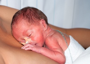 Frühgeborenes Baby stillt an der Brust mit Sonde