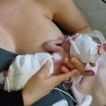 Frühgeborenes Baby an der Brust