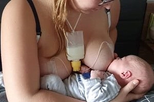 Frau stillt ihr Baby mithilfe eines Brusternährungssets