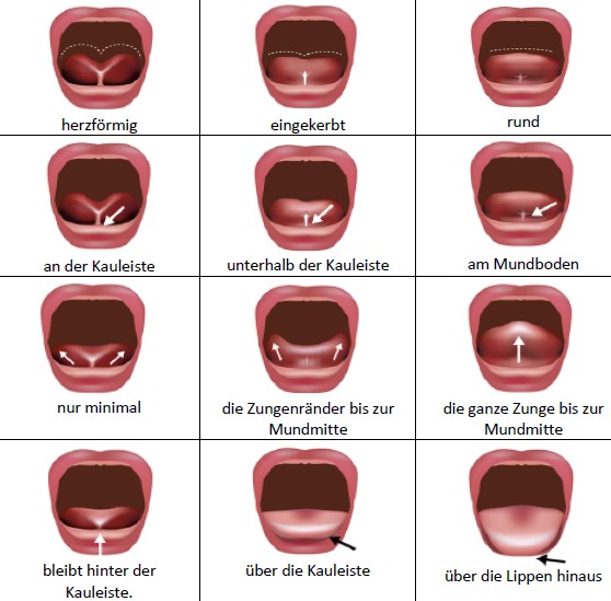 Das Deckblatt des BTAT / TABBY Beurteilungsinstruments für das zu kurze Zungenband mit 9 Bildern