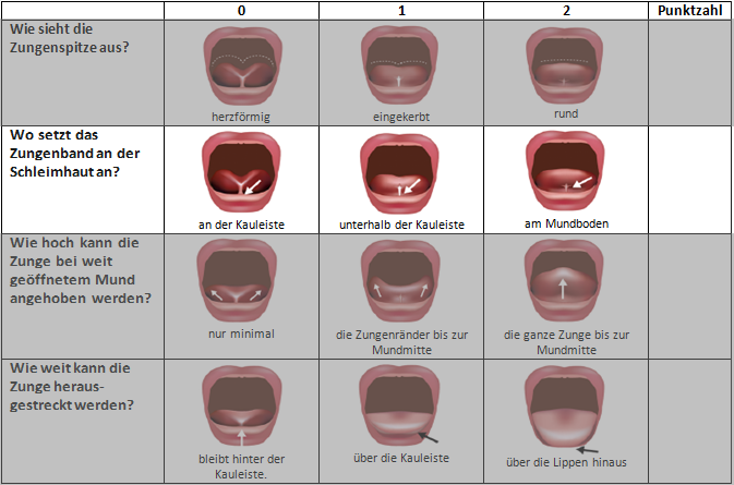 Der 2. Teil des BTAT / TABBY Beurteilungsbogens - Ansatzpunkt des Zungenbands