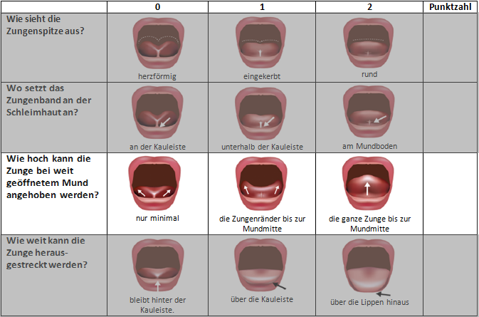 Der 3. Teil des BTAT / TABBY Beurteilungsbogens - Anheben der Zunge