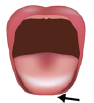 BTAT / TABBY Element Herausstrecken der Zunge über die Lippen hinaus
