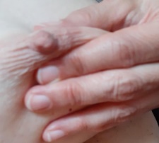 Teacup-Hold bei invertierten (eingezogenen) Brustwarzen