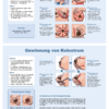 Stillplakat Brustmassage und Kolostrumgewinnung