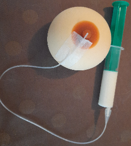 Schlauch mit Spritze auf einer Demo-Brust